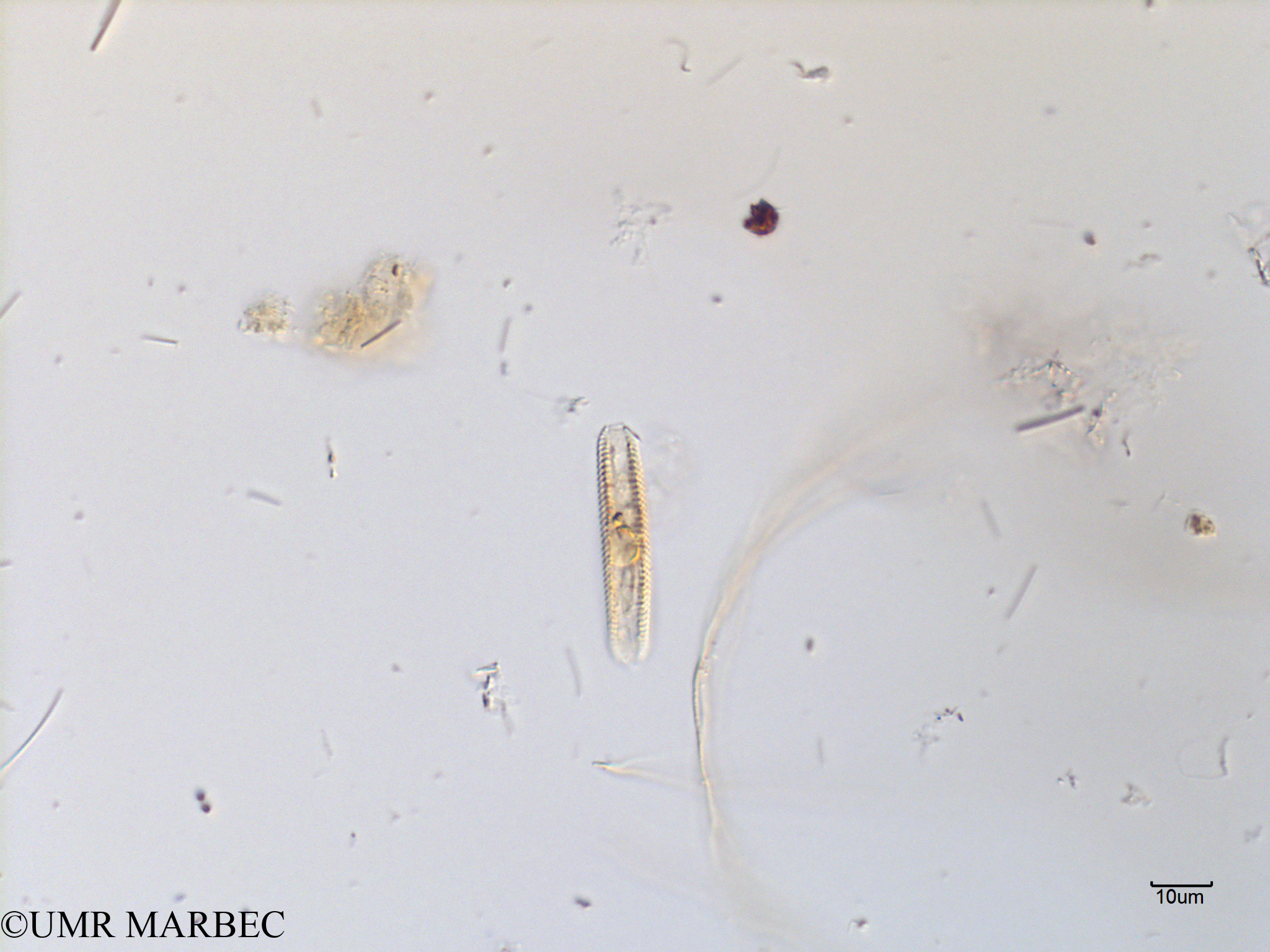 phyto/Scattered_Islands/mayotte_lagoon/SIREME May 2016/Pennée spp 5-10x50-100µm (MAY10_pennee laquelle).tif(copy).jpg